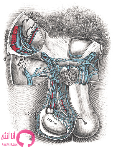 علاج دوالي الخصيتين